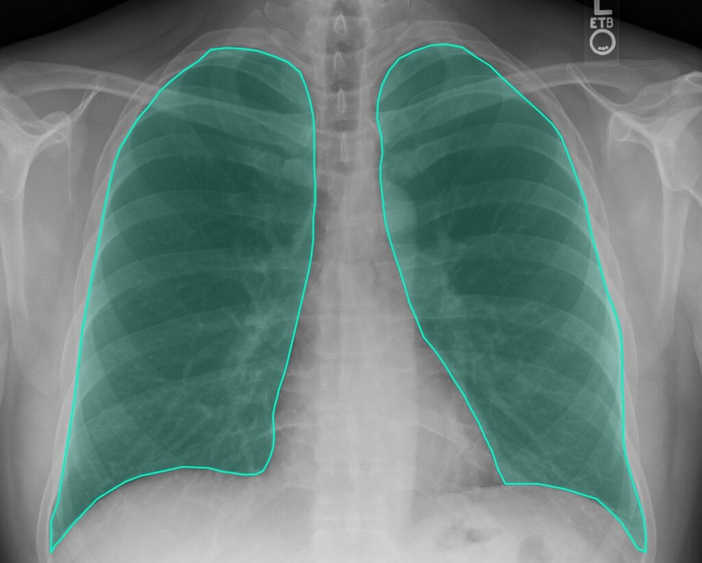Medical Image Annotation