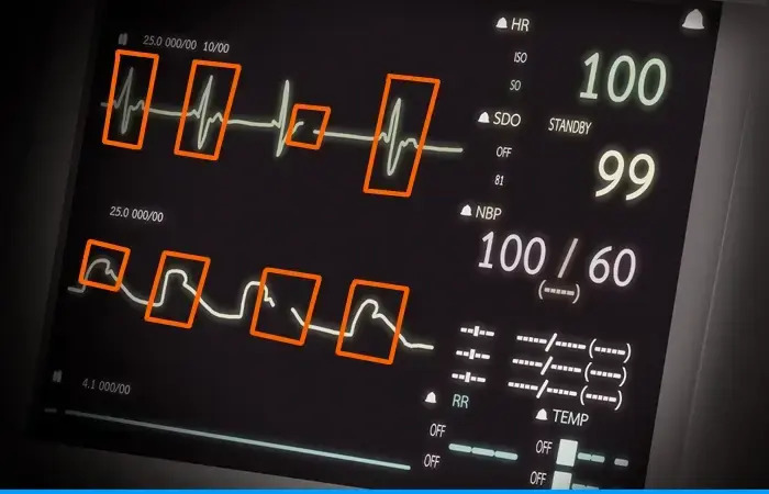 Medical Waveform Annotation